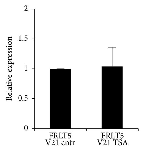 Effect Of The Histone Deacetylation Inhibitor Trichostatin A Tsa On