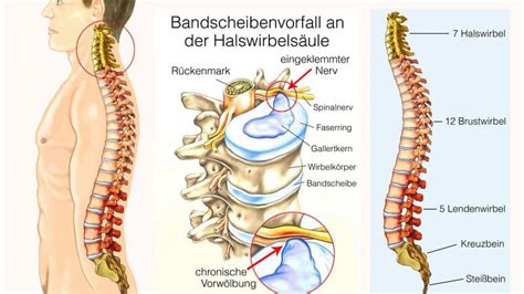 Hws Mrt Nutzen Anwendungsgebiete Und Durchf Hrung