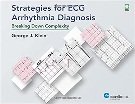 Strategies for ECG Arrhythmia Diagnosis Breaking Down Complexity ...