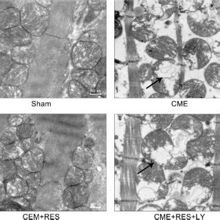 Myocardial Mitochondrial Morphology Observed By Transmission Electron