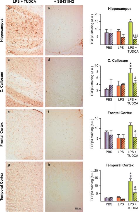 Tgf Receptor Inhibitor Sb Reduces Tudca Induction Of Tgf