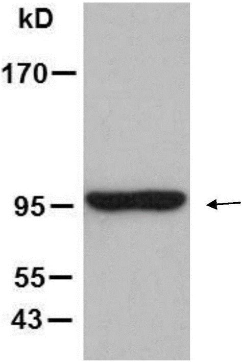 Application Of Heat Shock Protein Gp96 In Treatment Of Rheumatoid