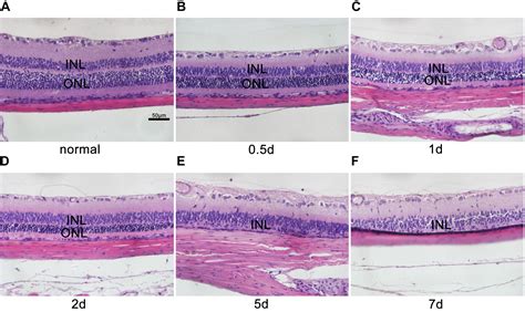 Frontiers M Ller Cell Regulated Microglial Activation And Migration