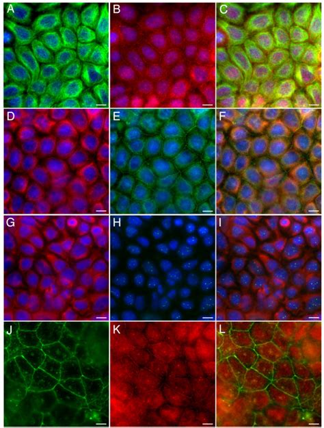 Junctional Staining Of The Colon Cancer Cell Line Caco Panels A C