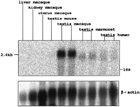 Northern Blot Hybridization Of Cdy Transcripts In Macaque Human And