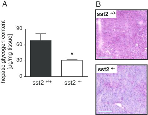 Hepatic Glycogen Content A Quantitative Determination Of Glycogen