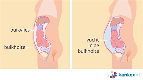 Olak Ajte Poklopac Ro En Ik Heb Er Mijn Buik Van Vol Betekenis Izvu I