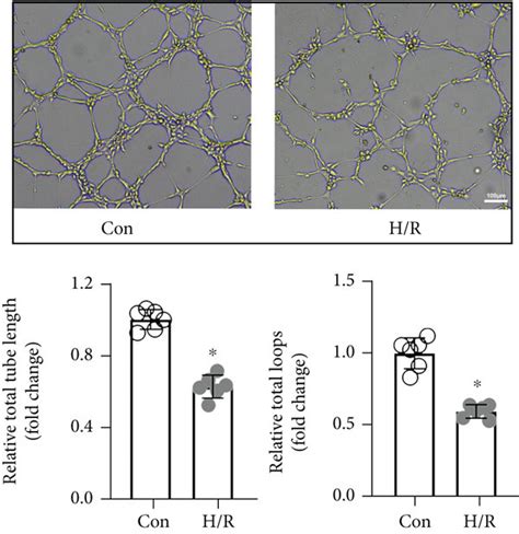 H R Treatment Resulted In CMEC Injury And Dysfunction A The