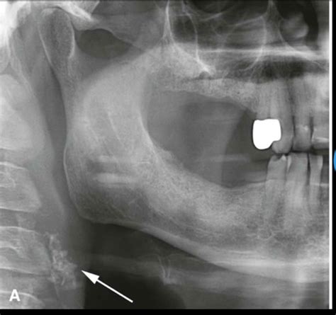 Radiography Ch Recognizing Normal Radiographic Anatomy Panoramic