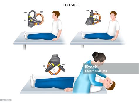 Dixhallpike Test Left Stock Illustration - Download Image Now - Alternative Therapy, Anatomy ...