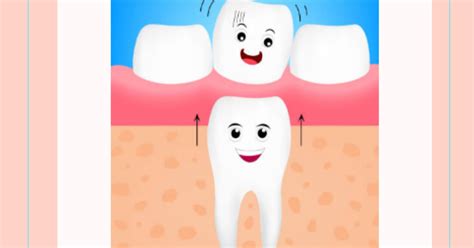 Quanto Tempo Demora Pra Nascer O Dente Permanente