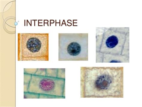 Mitosis lab Onion Root Tip