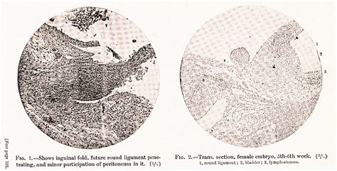 Figure 2 from The Physiological Descent of the Ovaries in the Human Fœtus | Semantic Scholar