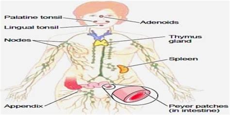 Lymphatic System Disorder Assignment Point