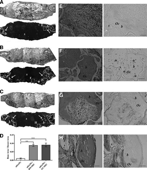 Histological Images Of Orthotopic Implants In Mouse Calvaria Recovered