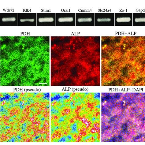 The Expression Of Marker For Maturation Stage Ameloblasts And Energy