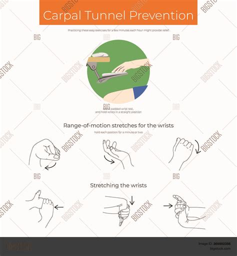 Exercises Carpal Vector & Photo (Free Trial) | Bigstock