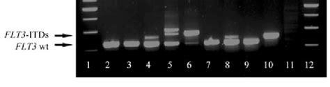 Agarose Gel Electrophoresis Of FLT3 ITD PCR Reactions Lanes 1 And 12