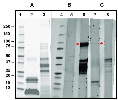 Sds Page And Ige Immunoblotting Of Patients Sera Against Apis