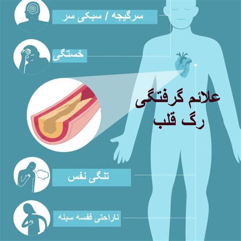 سوزش قفسه سینه از علائم گرفتگی رگ قلب در زنان و مردان دکتر آرزو خسروی