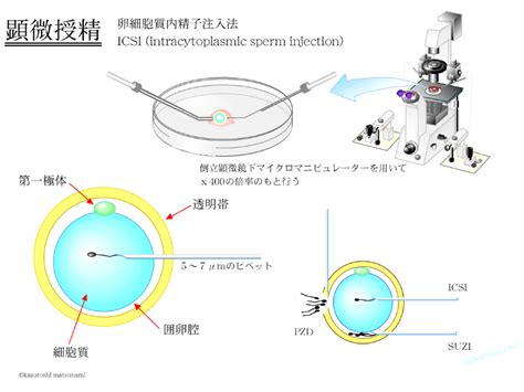 生殖補助医療（体外授精など）について 医療法人社団三圭会 山形 大手町 Artクリニック 川越医院