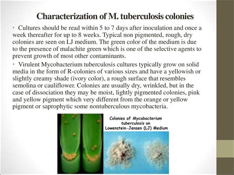 The General Diagnostics Of Tuberculosis Lecture 2 Online Presentation