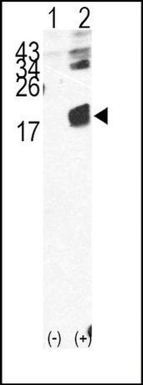 Beta 2 Microglobulin Polyclonal Antibody Pa5 12359