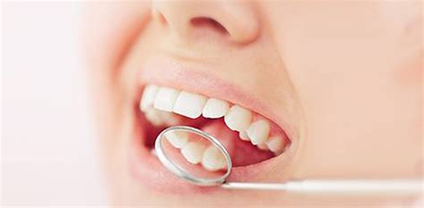 Cavities On Tooth Dental Treatment In Dilsukhnagar » Smile Dental