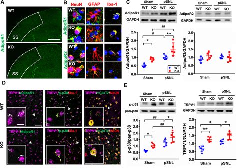 Adiponectin Regulates Thermal Nociception In A Mouse Model Of