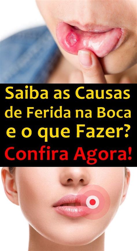 Causas De Ferida Na Boca E O Que Fazer Feridas Na Boca Dicas