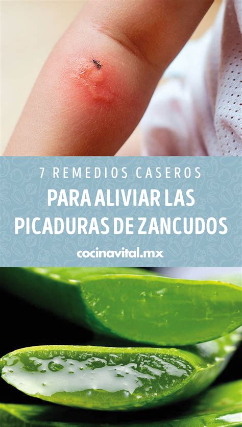 7 Remedios Caseros Para Aliviar Las Picaduras De Zancudos En 2020