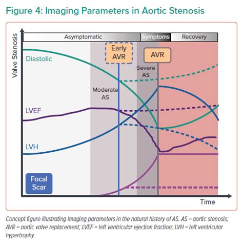 Imaging Parameters In Aortic Stenosis Radcliffe Cardiology