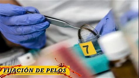 Aprende A Fijar Pelos Microscopia Criminalística Youtube