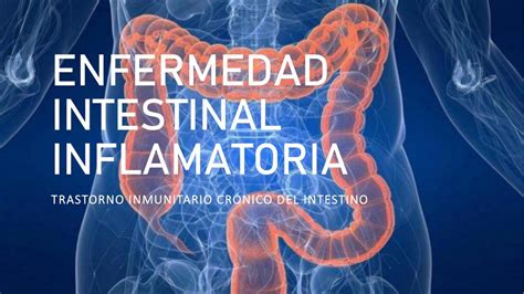 ENFERMEDAD INFLAMATORIA INTESTINAL Renzo Luján uDocz