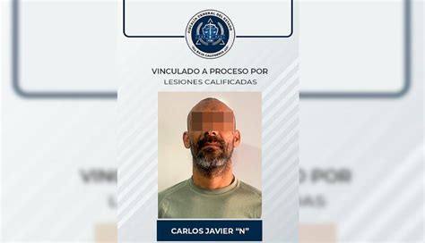 Vinculan A Proceso A Imputado Por Delito De Lesiones Calificadas