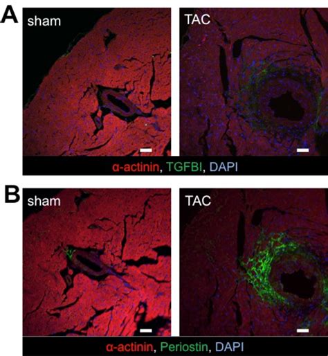 Figure 20 From Dissecting The Roles Of Periostin And TGFBI In