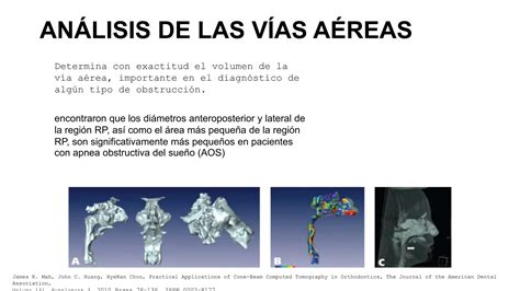 Tomografía Computarizada De Haz Cónico Cbct Pptx