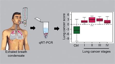 New Breath Test Provides Noninvasive Lung Cancer Diagnosis