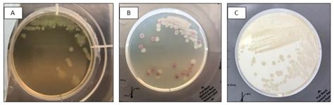 Pseudomonas Aeruginosa Culture