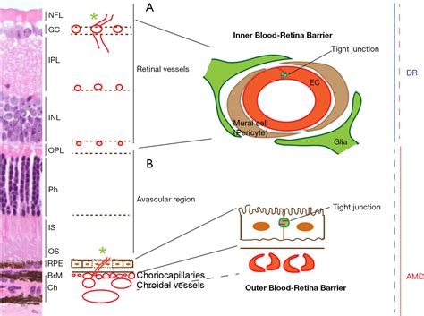 Inflammatory Pathways In Pathological Neovascularization In Retina And