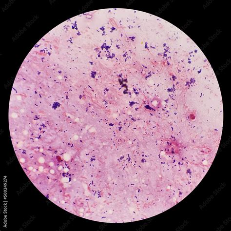 Cocci and bacilli bacteria in urine under 100X light microscope. Smear ...