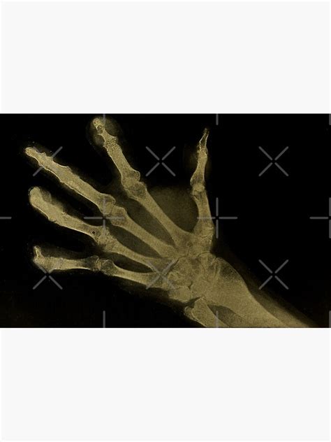 "CREEPY, SCARY, X-RAY SKELETON HAND X-RAY FACE MASK" Photographic Print for Sale by ...