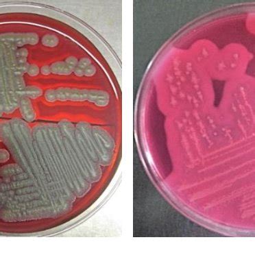 Bacillus cereus on gram stain (100X) | Download Scientific Diagram