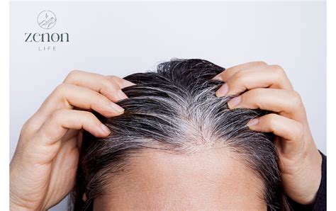 The Truth About Hair Thinning Causes And Solutions Zenon Life