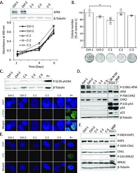 Atrx Deficiency Related Ddrs And Rs Were Not Induced In Tp Truncated