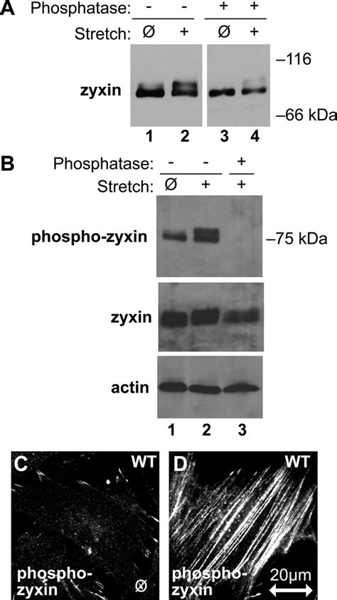 Posttranslational Modification Of Zyxin In Response To Stretch A