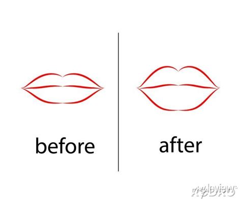 Lips Before And After Botox Injection Symbol Vector Illustration