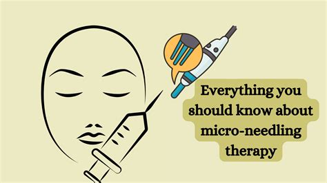 Everything You Should Know About Micro Needling Therapy Healthnord