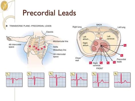 precordial leads | Medical knowledge, Ekg interpretation, Medical