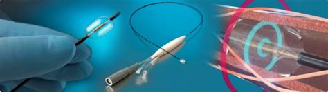 Fda Oks Recor Paradise™ Ultrasound Renal Denervation Medlatest Medical Device News